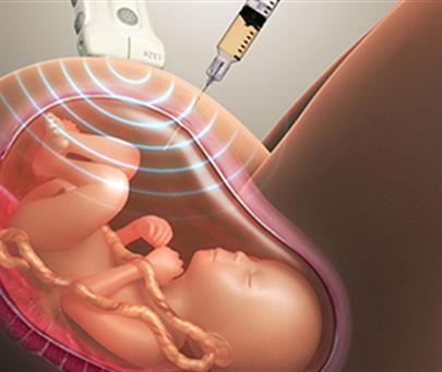 Pre-natal Invasive Tests (Amniocentesis and CVS)